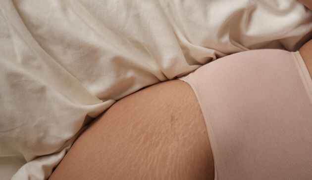 Sex after having a baby
