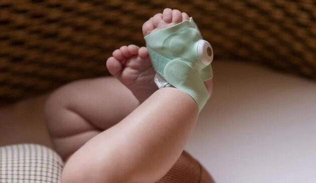 Owlet Smart Sock on baby